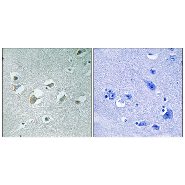 Immunohistochemistry - Anti-MLK1 + MLK2 (phospho Thr312 + Thr266) Antibody (A8142) - Antibodies.com