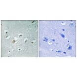 Immunohistochemistry - Anti-MLK1 + MLK2 (phospho Thr312 + Thr266) Antibody (A8142) - Antibodies.com