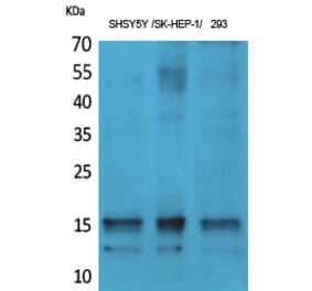 Western Blot - Anti-Synuclein-alpha (phospho Tyr125) Antibody (A7234) - Antibodies.com