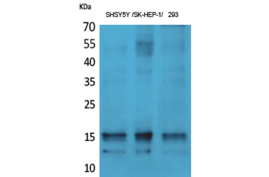 Western Blot - Anti-Synuclein-alpha (phospho Tyr125) Antibody (A7234) - Antibodies.com
