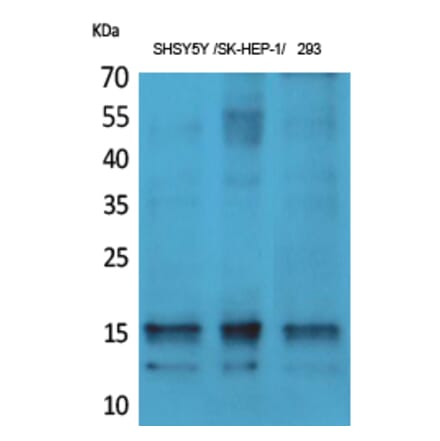 Western Blot - Anti-Synuclein-alpha (phospho Tyr125) Antibody (A7234) - Antibodies.com