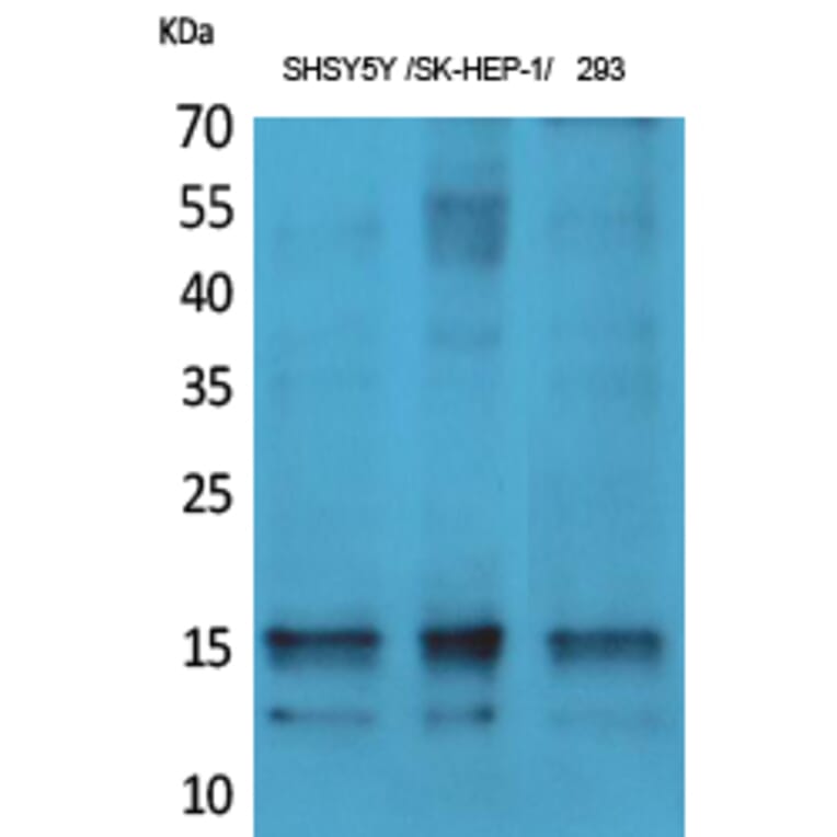 Western Blot - Anti-Synuclein-alpha (phospho Tyr125) Antibody (A7234) - Antibodies.com