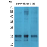 Western Blot - Anti-Synuclein-alpha (phospho Tyr125) Antibody (A7234) - Antibodies.com