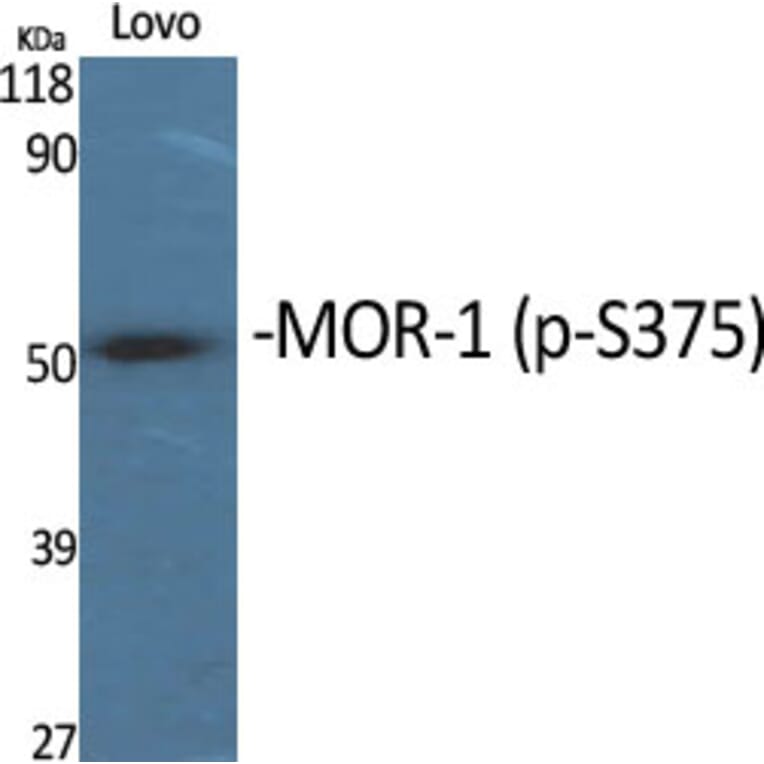 Western Blot - Anti-Opioid Receptor (phospho Ser375) Antibody (A0022) - Antibodies.com