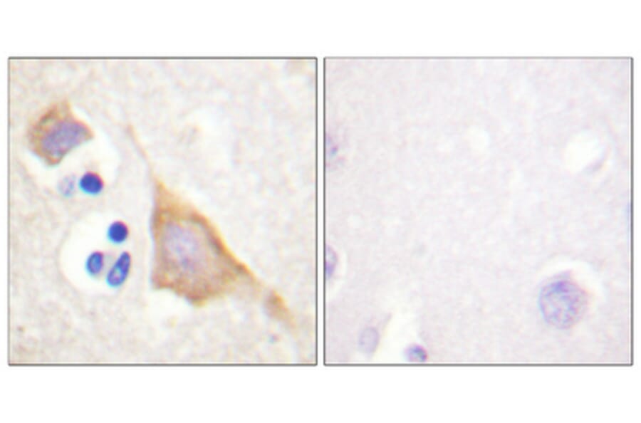 Immunohistochemistry - Anti-Opioid Receptor (phospho Ser375) Antibody (A0022) - Antibodies.com