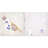 Immunohistochemistry - Anti-Opioid Receptor (phospho Ser375) Antibody (A0022) - Antibodies.com