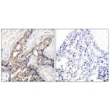 Immunohistochemistry - Anti-Abl (phospho Tyr393 + Tyr412) Antibody (A7003) - Antibodies.com