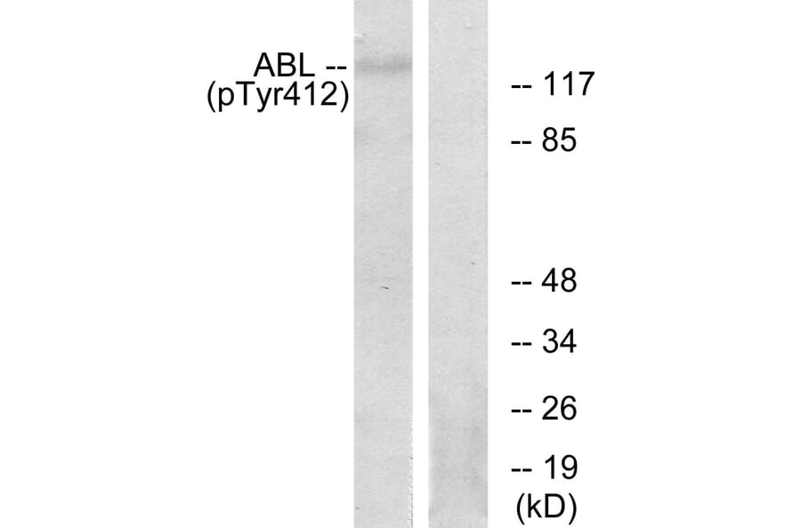 Western Blot - Anti-Abl (phospho Tyr393 + Tyr412) Antibody (A7003) - Antibodies.com