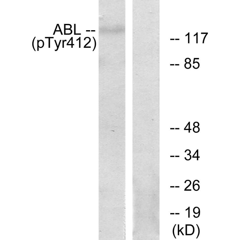 Western Blot - Anti-Abl (phospho Tyr393 + Tyr412) Antibody (A7003) - Antibodies.com