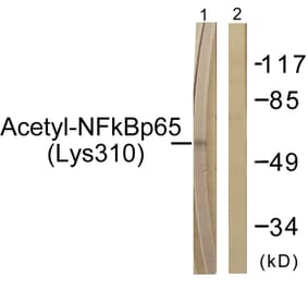 Western Blot - Anti-NF-kappaB p65 (acetyl Lys310) Antibody (D0018) - Antibodies.com