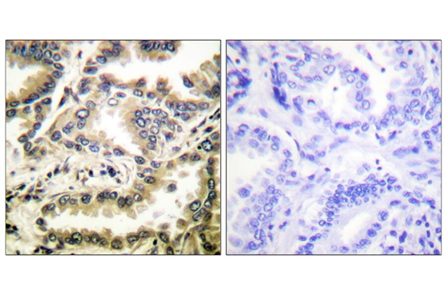 Immunohistochemistry - Anti-NF-kappaB p65 (acetyl Lys310) Antibody (D0018) - Antibodies.com
