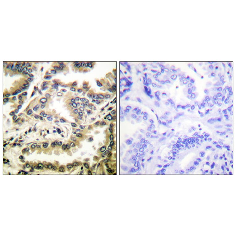 Immunohistochemistry - Anti-NF-kappaB p65 (acetyl Lys310) Antibody (D0018) - Antibodies.com