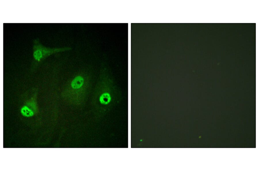 Immunofluorescence - Anti-NF-kappaB p65 (acetyl Lys310) Antibody (D0018) - Antibodies.com