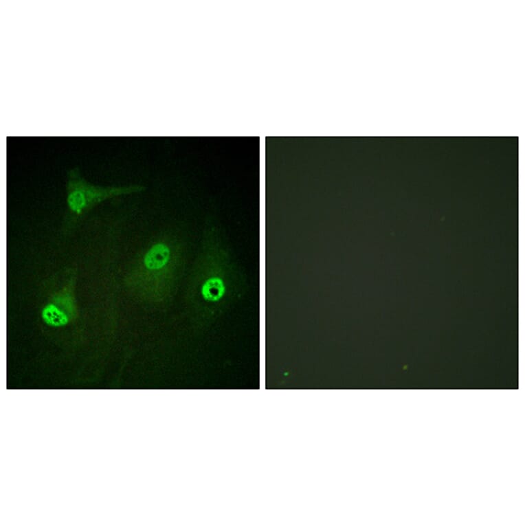 Immunofluorescence - Anti-NF-kappaB p65 (acetyl Lys310) Antibody (D0018) - Antibodies.com