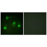 Immunofluorescence - Anti-NF-kappaB p65 (acetyl Lys310) Antibody (D0018) - Antibodies.com