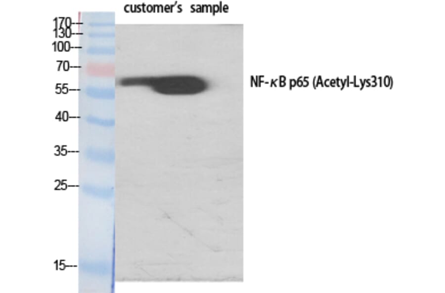 Western Blot - Anti-NF-kappaB p65 (acetyl Lys310) Antibody (D0018) - Antibodies.com