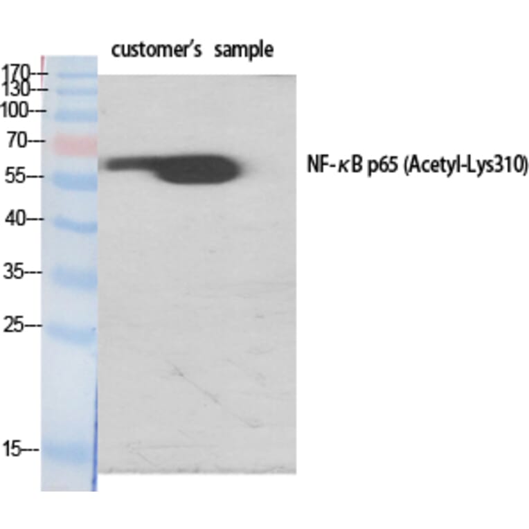 Western Blot - Anti-NF-kappaB p65 (acetyl Lys310) Antibody (D0018) - Antibodies.com