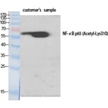 Western Blot - Anti-NF-kappaB p65 (acetyl Lys310) Antibody (D0018) - Antibodies.com