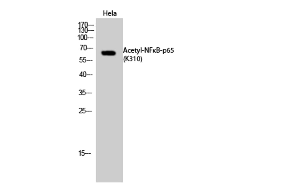 Western Blot - Anti-NF-kappaB p65 (acetyl Lys310) Antibody (D0018) - Antibodies.com