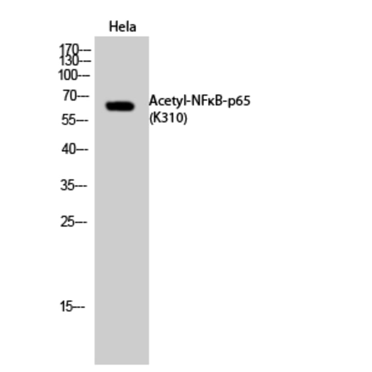 Western Blot - Anti-NF-kappaB p65 (acetyl Lys310) Antibody (D0018) - Antibodies.com