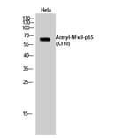 Western Blot - Anti-NF-kappaB p65 (acetyl Lys310) Antibody (D0018) - Antibodies.com
