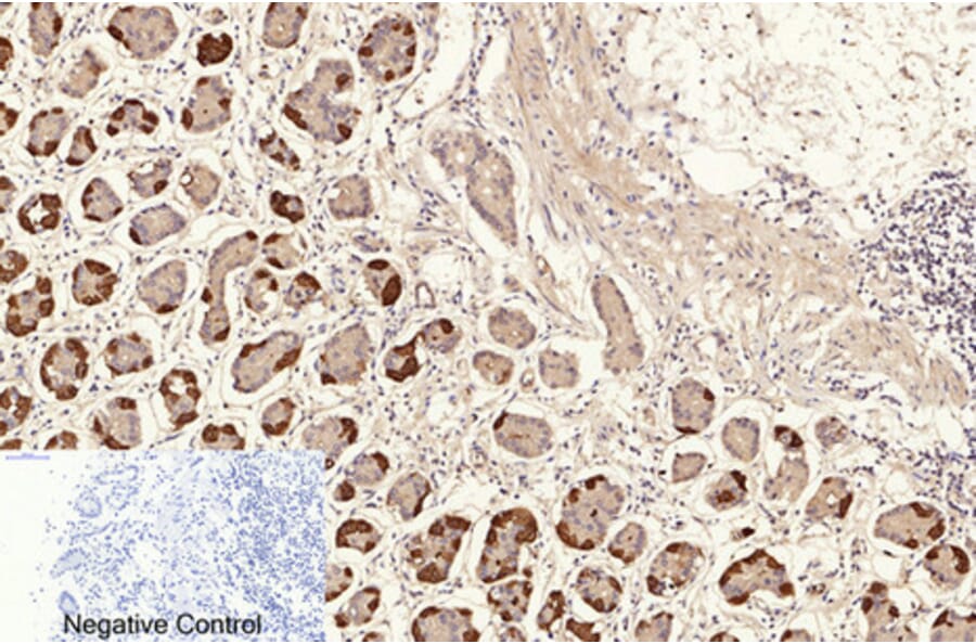 Immunohistochemistry - Anti-NF-kappaB p65 (acetyl Lys310) Antibody (D0018) - Antibodies.com