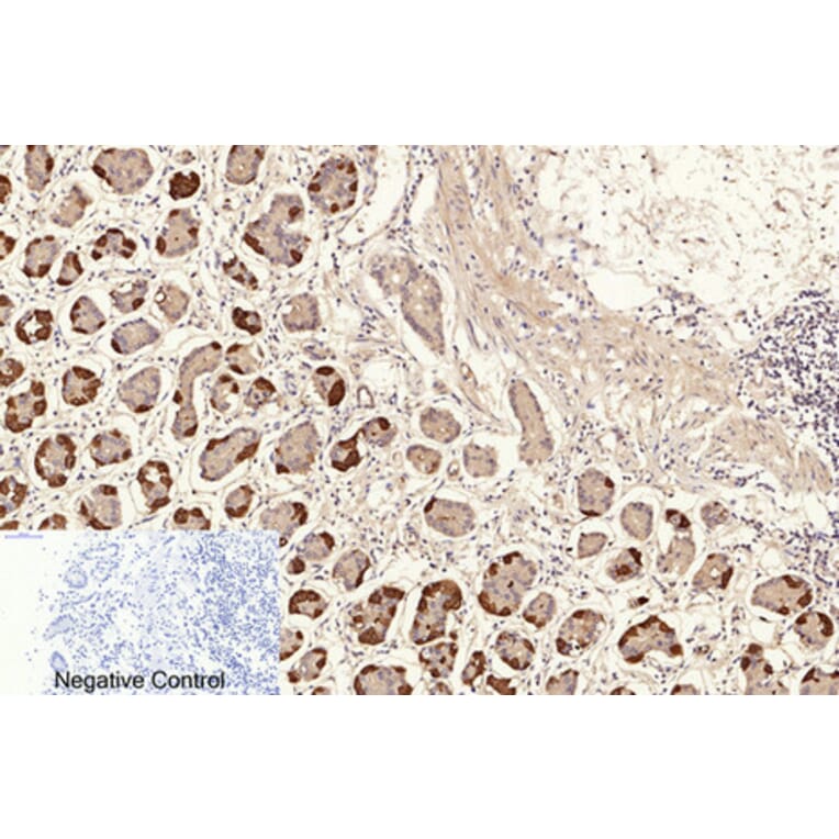 Immunohistochemistry - Anti-NF-kappaB p65 (acetyl Lys310) Antibody (D0018) - Antibodies.com