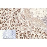 Immunohistochemistry - Anti-NF-kappaB p65 (acetyl Lys310) Antibody (D0018) - Antibodies.com