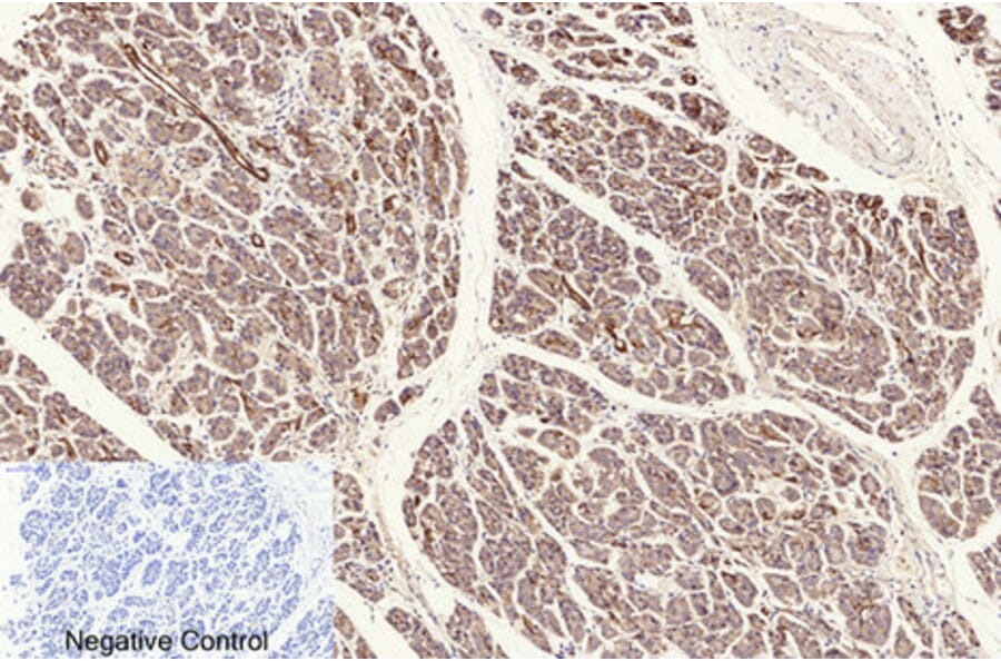 Immunohistochemistry - Anti-NF-kappaB p65 (acetyl Lys310) Antibody (D0018) - Antibodies.com