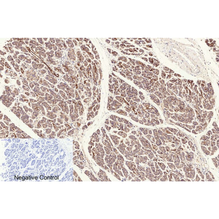 Immunohistochemistry - Anti-NF-kappaB p65 (acetyl Lys310) Antibody (D0018) - Antibodies.com