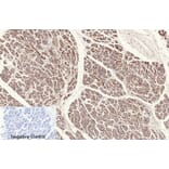 Immunohistochemistry - Anti-NF-kappaB p65 (acetyl Lys310) Antibody (D0018) - Antibodies.com