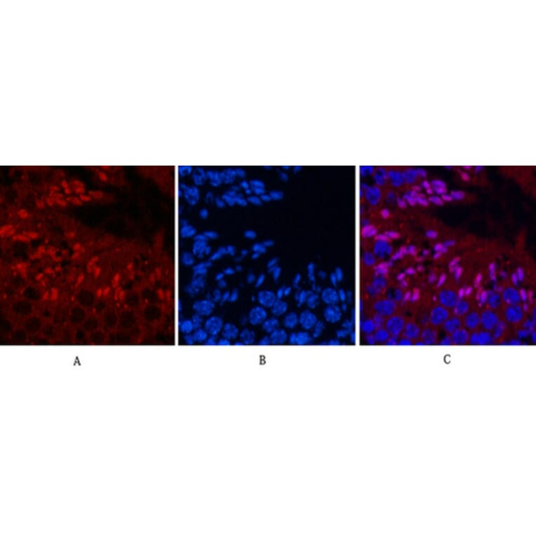Immunofluorescence - Anti-NF-kappaB p65 (acetyl Lys310) Antibody (D0018) - Antibodies.com