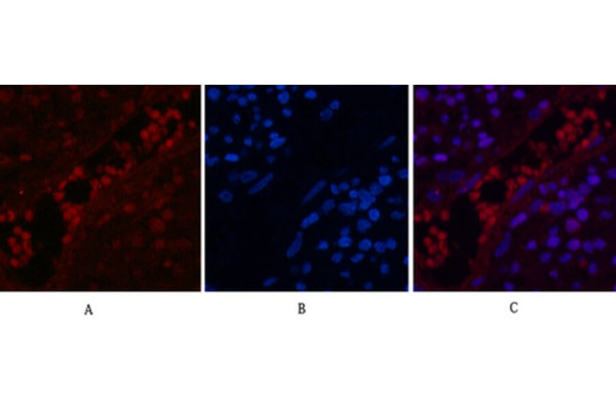 Immunofluorescence - Anti-NF-kappaB p65 (acetyl Lys310) Antibody (D0018) - Antibodies.com