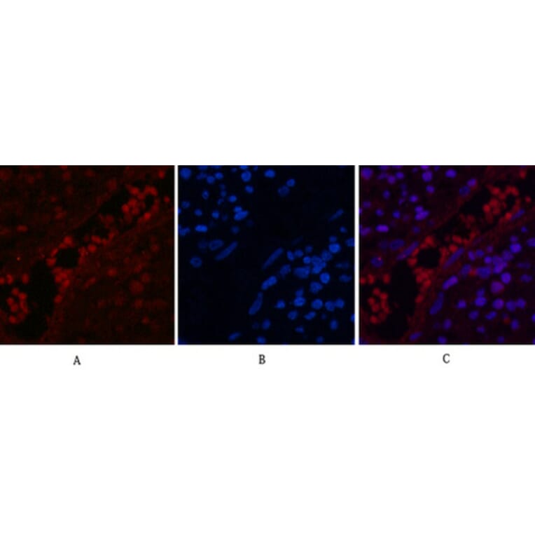 Immunofluorescence - Anti-NF-kappaB p65 (acetyl Lys310) Antibody (D0018) - Antibodies.com