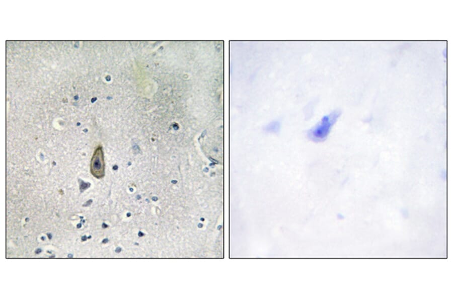Immunohistochemistry - Anti-ROMK (phospho Ser44 + Ser25) Antibody (A1121) - Antibodies.com