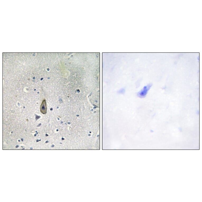 Immunohistochemistry - Anti-ROMK (phospho Ser44 + Ser25) Antibody (A1121) - Antibodies.com