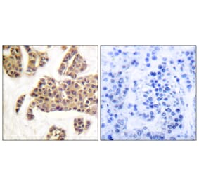 Immunohistochemistry - Anti-BAD (phospho Ser91 + Ser128) Antibody (A0821) - Antibodies.com