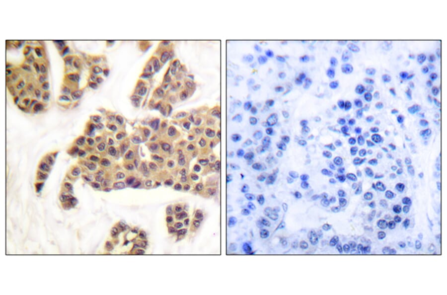 Immunohistochemistry - Anti-BAD (phospho Ser91 + Ser128) Antibody (A0821) - Antibodies.com