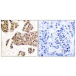 Immunohistochemistry - Anti-BAD (phospho Ser91 + Ser128) Antibody (A0821) - Antibodies.com