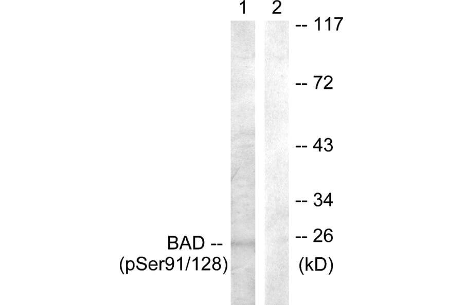 Western Blot - Anti-BAD (phospho Ser91 + Ser128) Antibody (A0821) - Antibodies.com