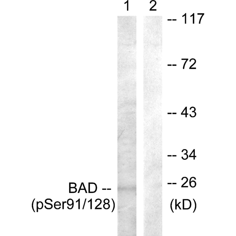 Western Blot - Anti-BAD (phospho Ser91 + Ser128) Antibody (A0821) - Antibodies.com