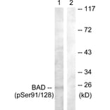 Western Blot - Anti-BAD (phospho Ser91 + Ser128) Antibody (A0821) - Antibodies.com