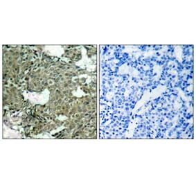 Immunohistochemistry - Anti-MEK1 + MEK2 (phospho Ser221) Antibody (A7147) - Antibodies.com