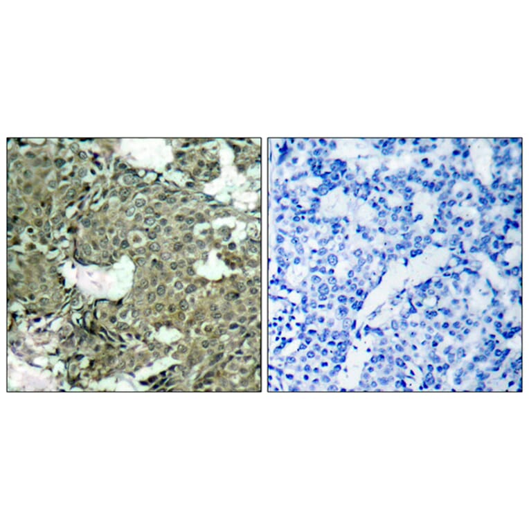 Immunohistochemistry - Anti-MEK1 + MEK2 (phospho Ser221) Antibody (A7147) - Antibodies.com