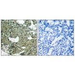 Immunohistochemistry - Anti-MEK1 + MEK2 (phospho Ser221) Antibody (A7147) - Antibodies.com