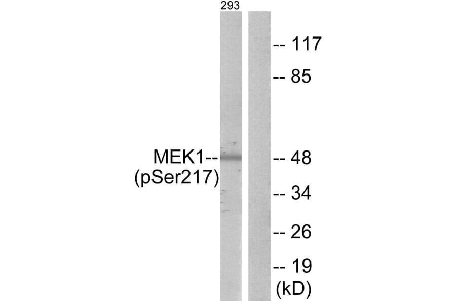 Western Blot - Anti-MEK1 + MEK2 (phospho Ser217) Antibody (A7146) - Antibodies.com