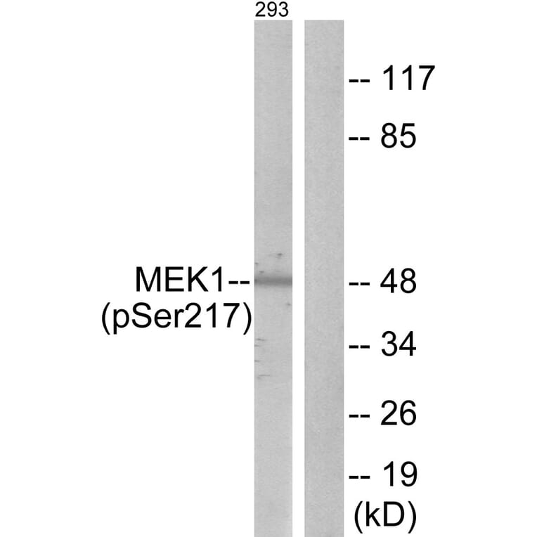 Western Blot - Anti-MEK1 + MEK2 (phospho Ser217) Antibody (A7146) - Antibodies.com