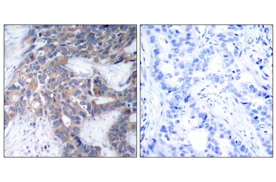 Immunohistochemistry - Anti-MEK1 + MEK2 (phospho Ser217) Antibody (A7146) - Antibodies.com