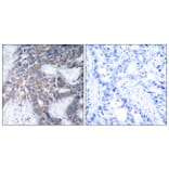 Immunohistochemistry - Anti-MEK1 + MEK2 (phospho Ser217) Antibody (A7146) - Antibodies.com