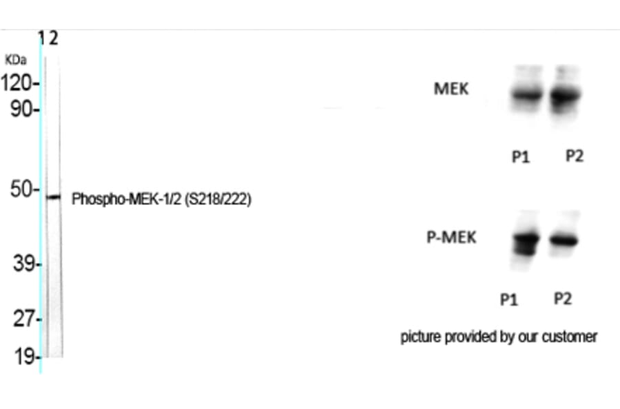 Western Blot - Anti-MEK1 + MEK2 (phospho Ser217) Antibody (A7146) - Antibodies.com